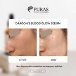 Buy Dragon’s Blood Antioxidant Glow Serum In Malaysia