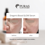 Buy Dragon’s Blood Antioxidant Glow Serum In Malaysia