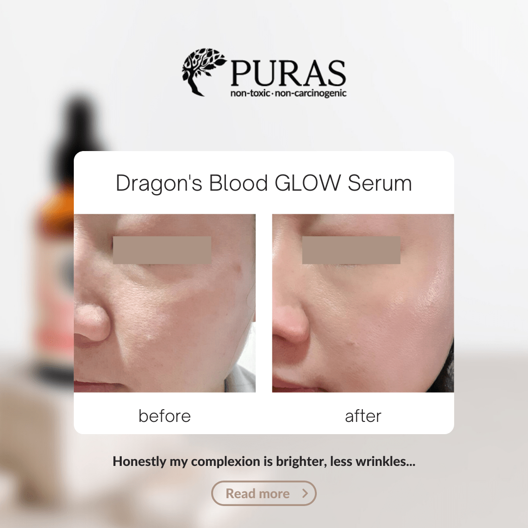 Buy Dragon’s Blood Antioxidant Glow Serum In Malaysia
