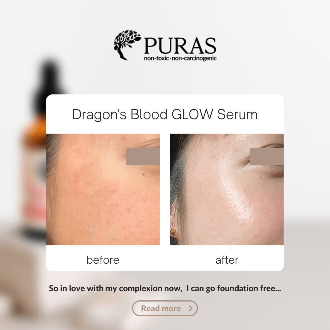 Buy Dragon’s Blood Antioxidant Glow Serum In Malaysia