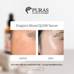 Buy Dragon’s Blood Antioxidant Glow Serum In Malaysia